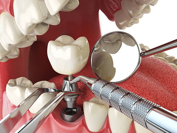 Best Emergency Dental Care for Abscessed Tooth in Tryon, NC
